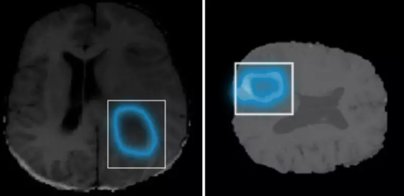 SAM demonstrates consistent segmentation performance in less complex medical images
